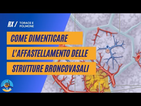 Video: Cosa significa diffusione linfangitica?