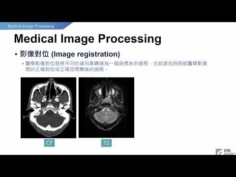 以案例剖析AI智慧醫療影像辨識技術試讀影片 影像對位