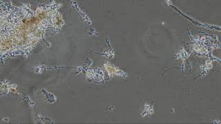 Bacteria and ciliates