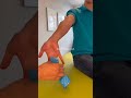 Carpal tunnel syndrome #wristpain #sensation #k_tapping #physiotherapy #pain #happyrepublicday #dr