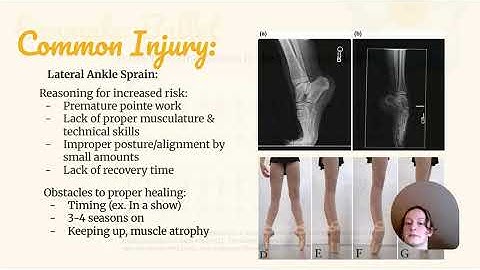 Science Ambassador Scholarship Video - How Understanding Biomechanics Prevents Injury