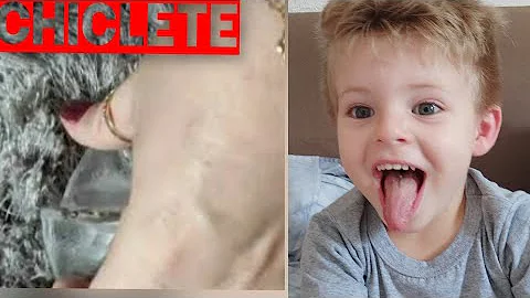 Como tirar chiclete do cobertor?