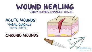 Wound Healing   Osmosis