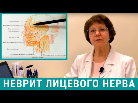 Неврит лицевого нерва: лечение причины