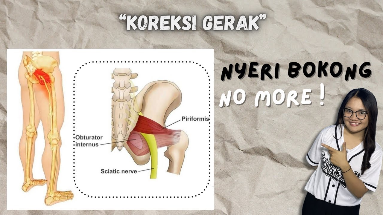 Cara Mengatasi Saraf Terjepit pada Bokong “PIRIFORMIS SYNDROME” #movewell 