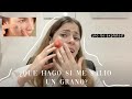 ME SALIÓ UN GRANO, QUÉ DEBO HACER? | Dermatóloga responde