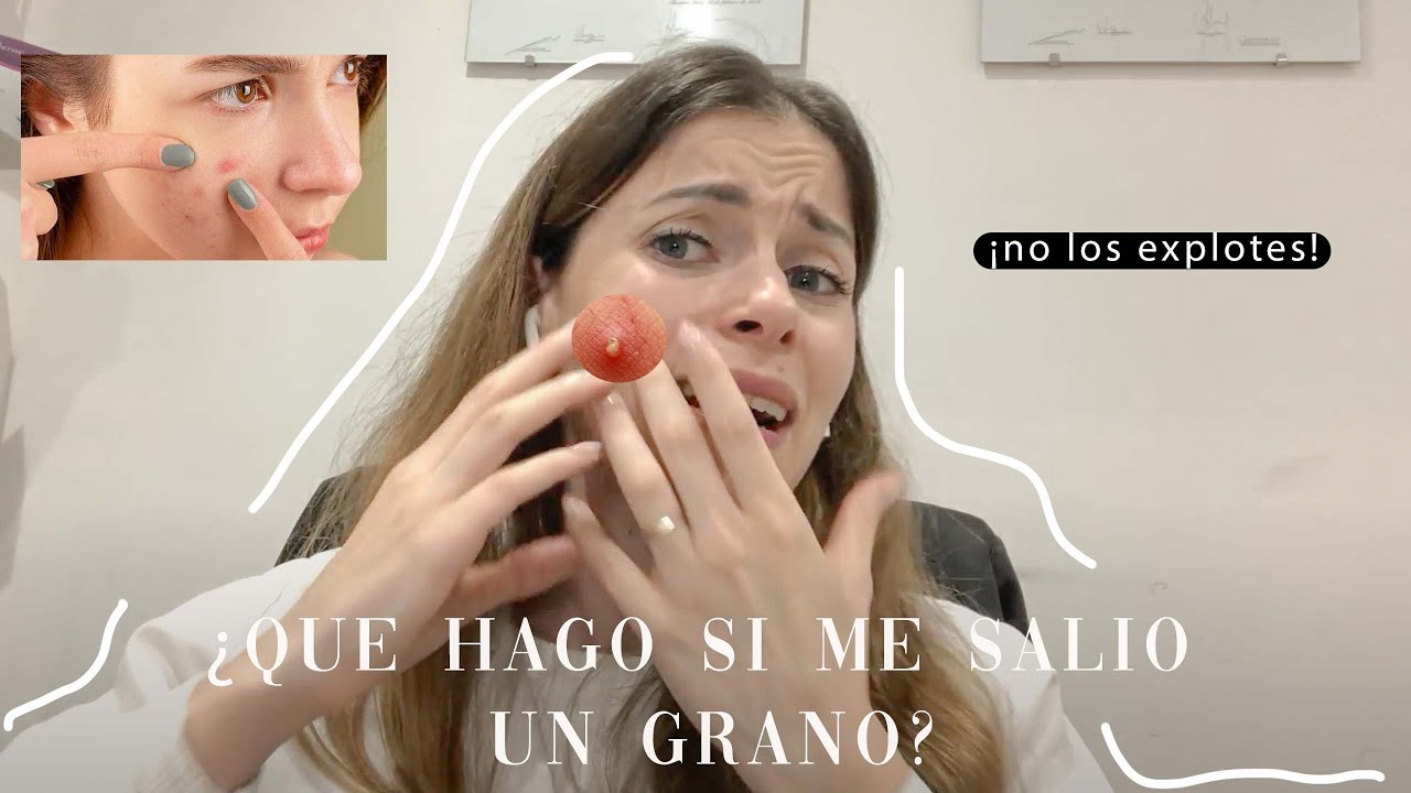 Me Puse Ajo En Un Grano Y Me Arde