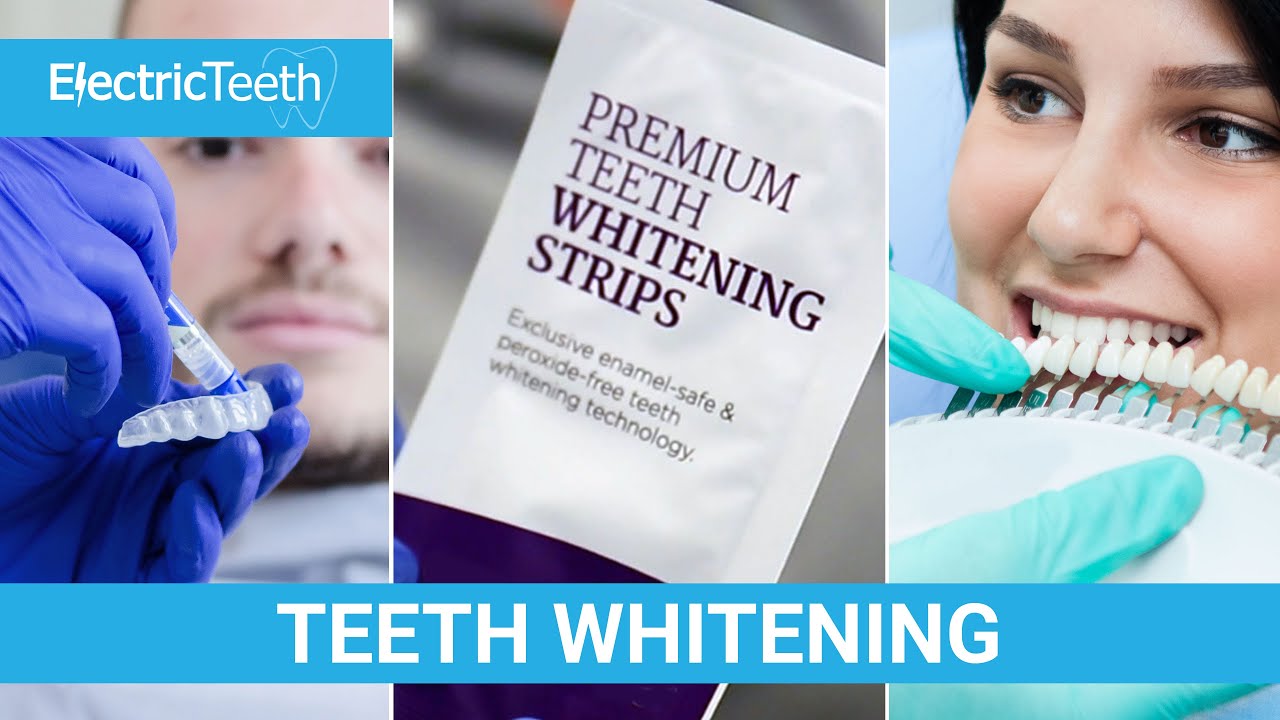 Teeth Whitening All the things you need to know YouTube