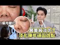 醫美級淡斑！搶救陳年超頑固斑點 連續擦1個月效果揭曉 ll Kevin想得美 ll Remove DARK SPOTS
