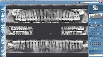 Working with Studies and Study Templates in Planmeca Romexis©