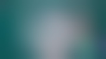 Robotic Transperitoneal Pyeloplasty by Dr Elmes