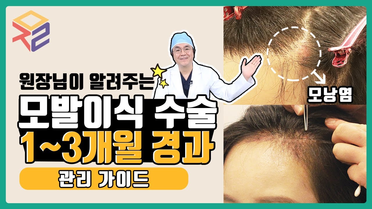 Mojelim Care Guide 1-3 Months After A Hair Transplant - Youtube