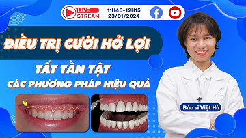 #Vinalign - Livestream chủ đề: Cười hở lợi và các phương pháp điều trị hiệu quả