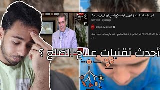 أحدث تقنيات علاج الصلع ؟ كيفية علاج الصلع في سن مبكر