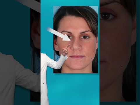 Video thumbnail: Can you tell by the nose? · Dr Steven Dayan, MD, FACS - Facial Plastic Surgeon