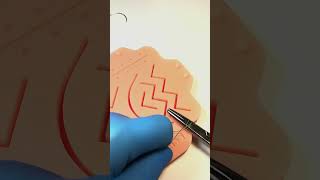 Трепанация | Тренажер Scalpel med