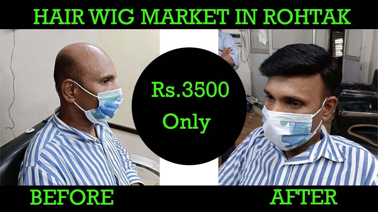 Hair Wig Market in Rohtak Hair Wig in Rohtak Hair Wig service in