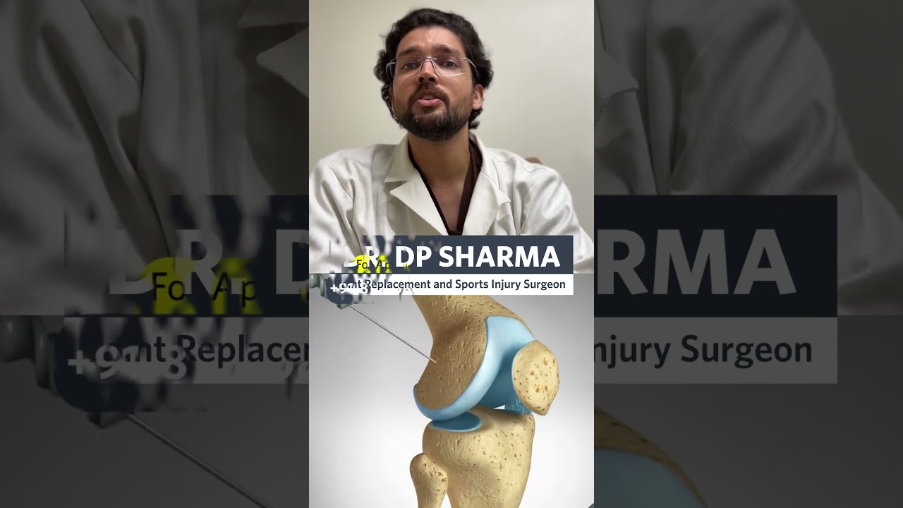 Live ACL Ligament Surgery by the Best Sports Injury Surgeon in Delhi-NCR and Agra, Dr. DP Sharma
