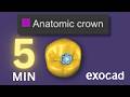 Exocad 3 2 Design Perfect Crown In 5 Minutes