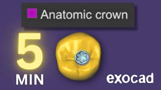 Exocad 3.2 : Design Perfect Crown in 5 Minutes