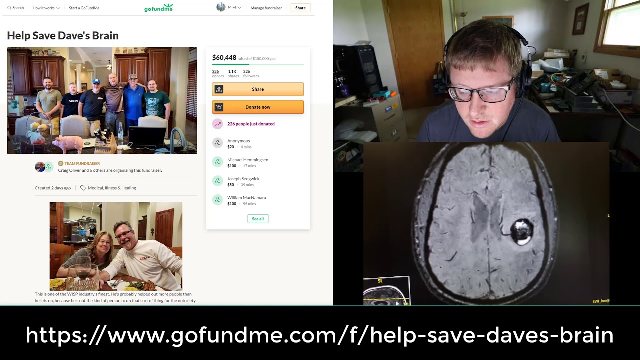 #SaveDavesBrain