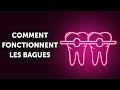 Comment Fonctionnent les Bagues (et Pourquoi aussi Lentement)