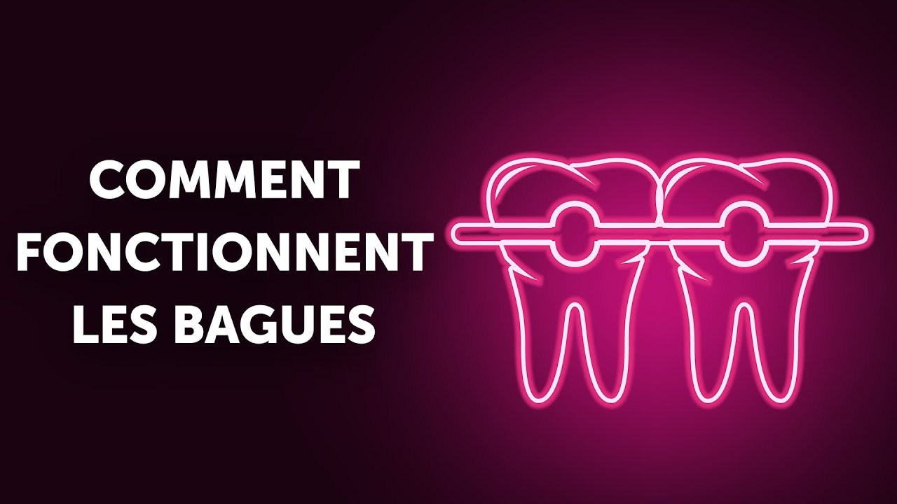 Comment Fonctionnent les Bagues (et Pourquoi aussi Lentement)