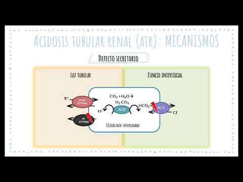 11-2018 Acidosis Tubular Renal Distal