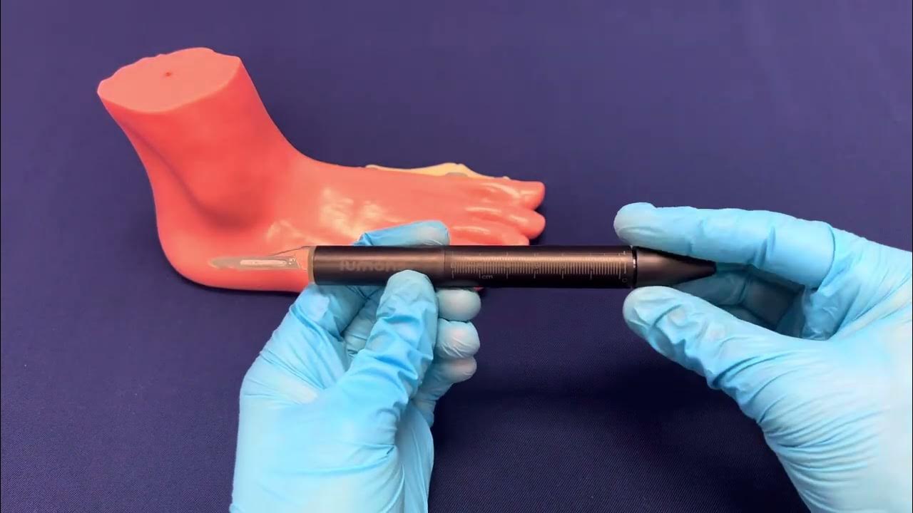 Lumohs illuminating blade handle by gill podiatry supply co youtube