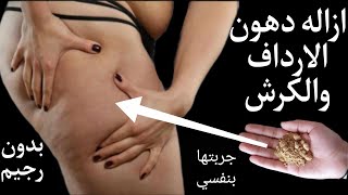 معلقه سحريه هتخسي عليها كل يوم أكثر من 4 كيلو دهون من الكرش والارداف والجوانب بدون رجيم ولا تمارين.