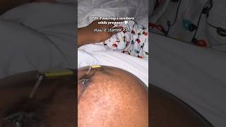 FOSTER A NEWBORN WHILE PREGNANT then vs now 🥹🎀🤍
