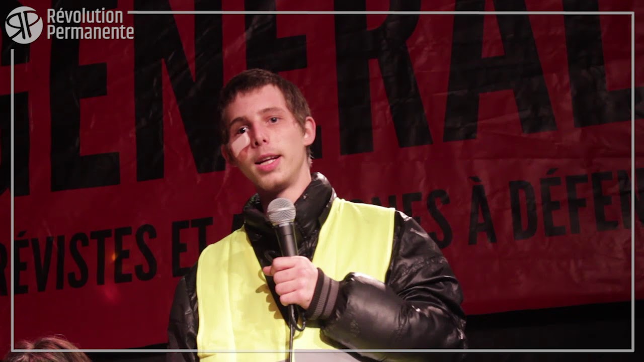 Franck Didron 20 Ans éborgné Par Lbd40 Ce Que Jai Subi Fait De Moi Ce Que Je Suis