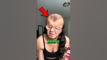 Skull Deformation 😱