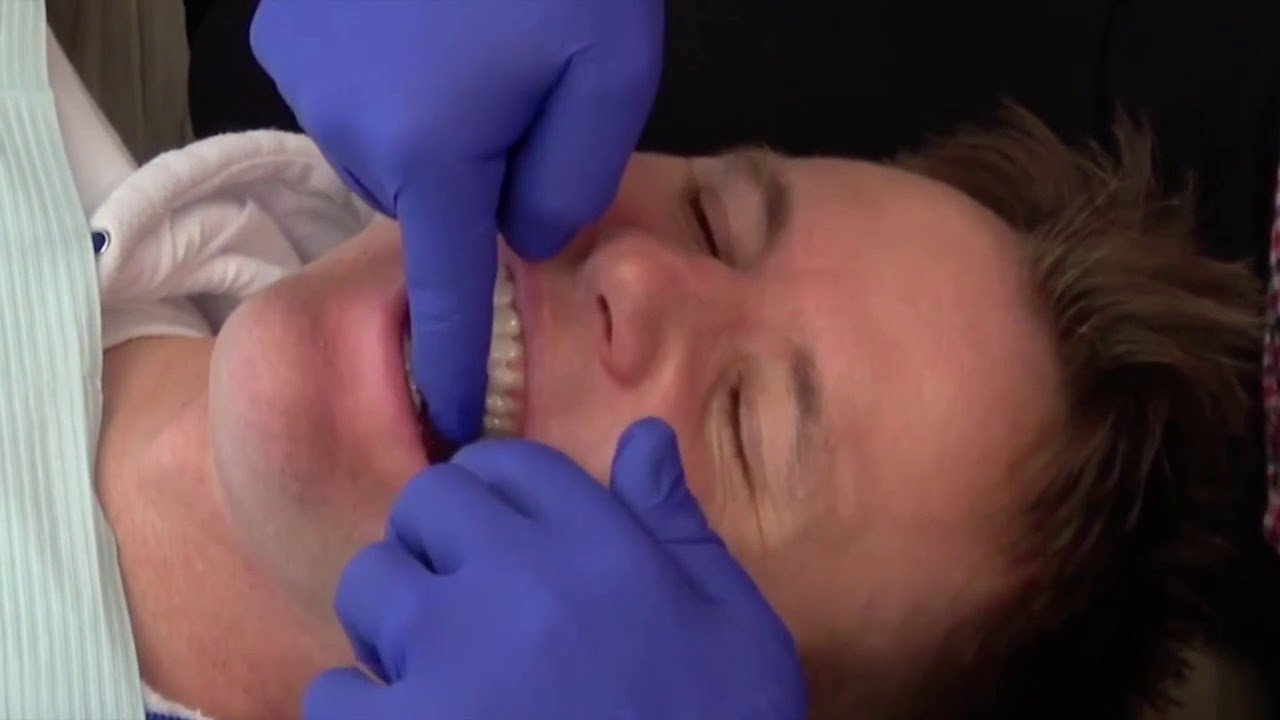 Tannregulering Grünerløkka