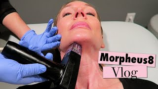 Morpheus8 Neck Treatment &amp; Recovery Vlog!