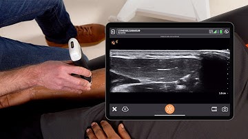 Scanning the Radial Nerve