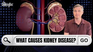 What Causes Kidney Disease? | The Cooking Doc®