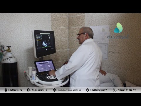 مدير مركز جراحة القلب بالموصل ضرورة توفير مستلزمات العمليات للتقليل من قائمة الانتظار