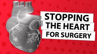 Surgeon Q&A Stopping The Heart During Cardiac Surgery