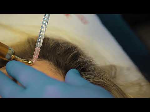 Vidéo: Baby Botox: Faits, Procédure, Risques Et à Quoi S'attendre