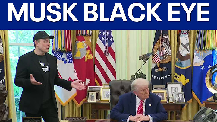 Elon Musk's black eye: Here's how he said he got it