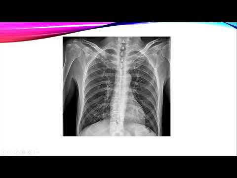 آناتومی رادیولوژیک و تشخیصی قفسه سینه دکتر محمدی پور