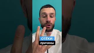 Основные причины отёков