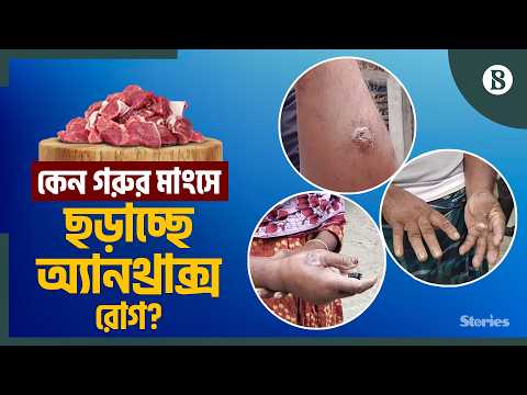 গরুর মাংস ছুঁলেই হাতে ফোস্কা; আক্রান্ত শতাধিক | The Business Standard