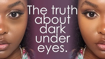 TREATING DARK CIRCLES & PUFFY UNDEREYES - Causes & Treatments, An Esthetician
