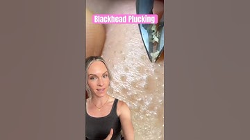 MOST SATISFYING BLACKHEAD PLUCKING REMOVAL #shorts