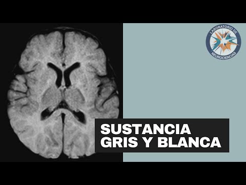 Vídeo: Diferencia Entre Materia Blanca Y Materia Gris