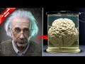 How albert einstein s brain was different from other human beings mp3