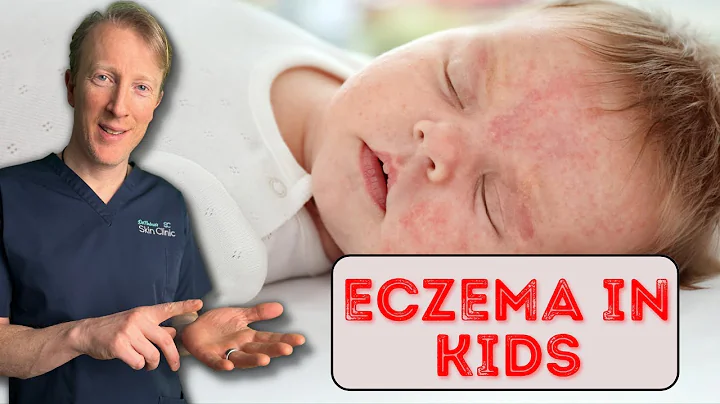 How to treat Eczema in Babies & Children: Dermatology Doctor explains