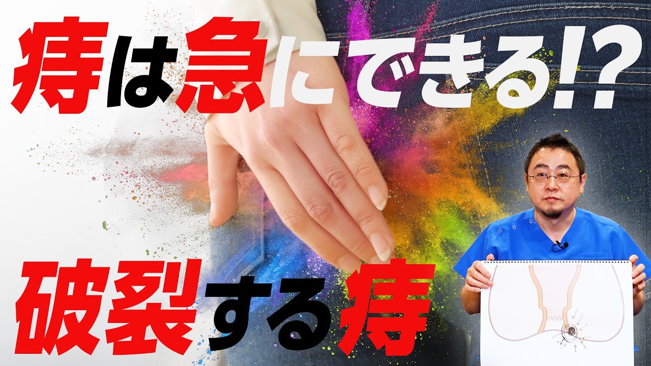 【痔の破裂】痔は急にできる!? 血栓性外痔核・肛門周囲膿瘍|いぼ痔・切れ痔・痔ろう・痔瘻・痔の手術 - YouTube